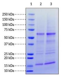 SDS-PAGE (KAT5-021H).jpg